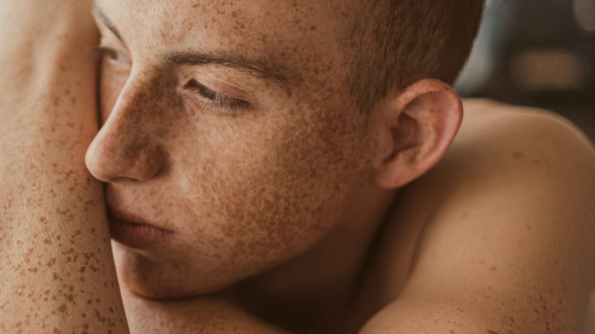 
a man with freckles on his body laying on a bed
